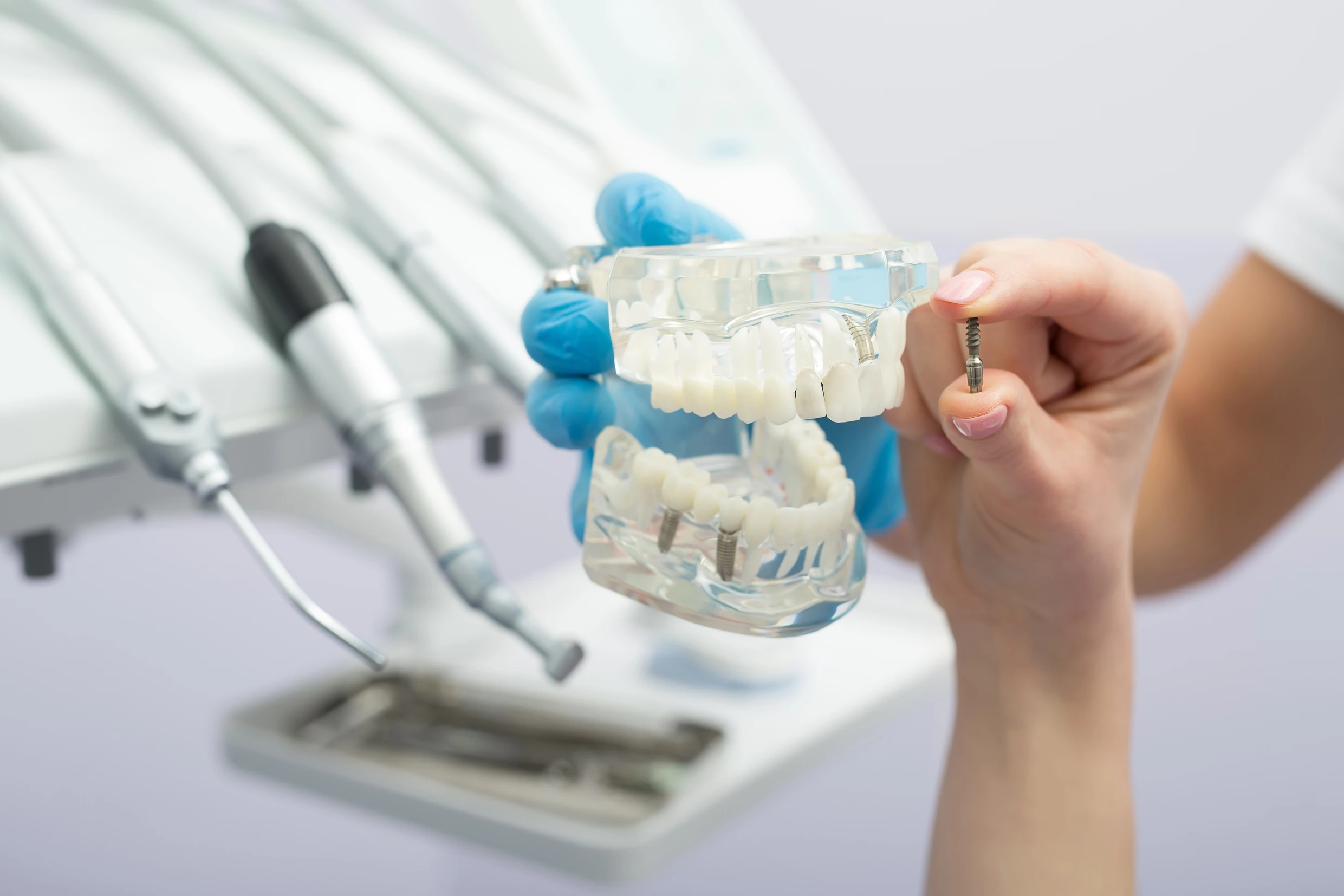 What are the Benefits of Dental Implants? Fort Worth and Arlington Dentist Explains