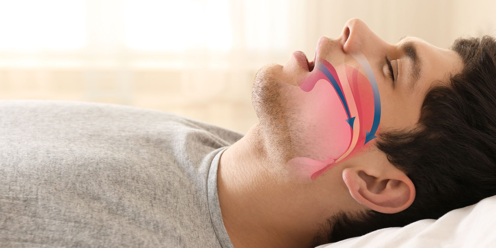 Sleep Apnea Treatment Fort Worth, TX Arlington, TX