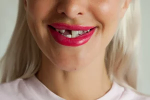 dental patient missing her front tooth