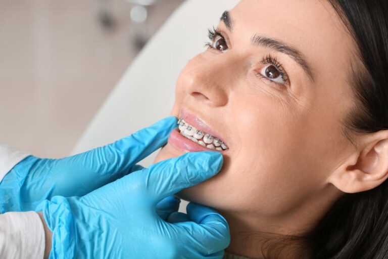How Much Do Braces Cost? Cost Breakdown 2024