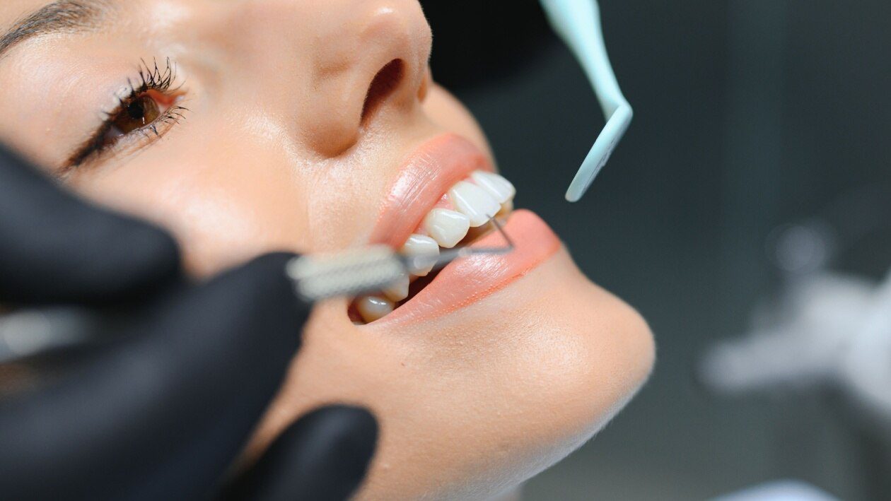 Woman getting a dental cleaning