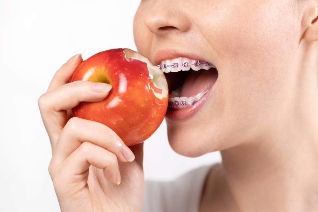 Girl eating an apple with braces